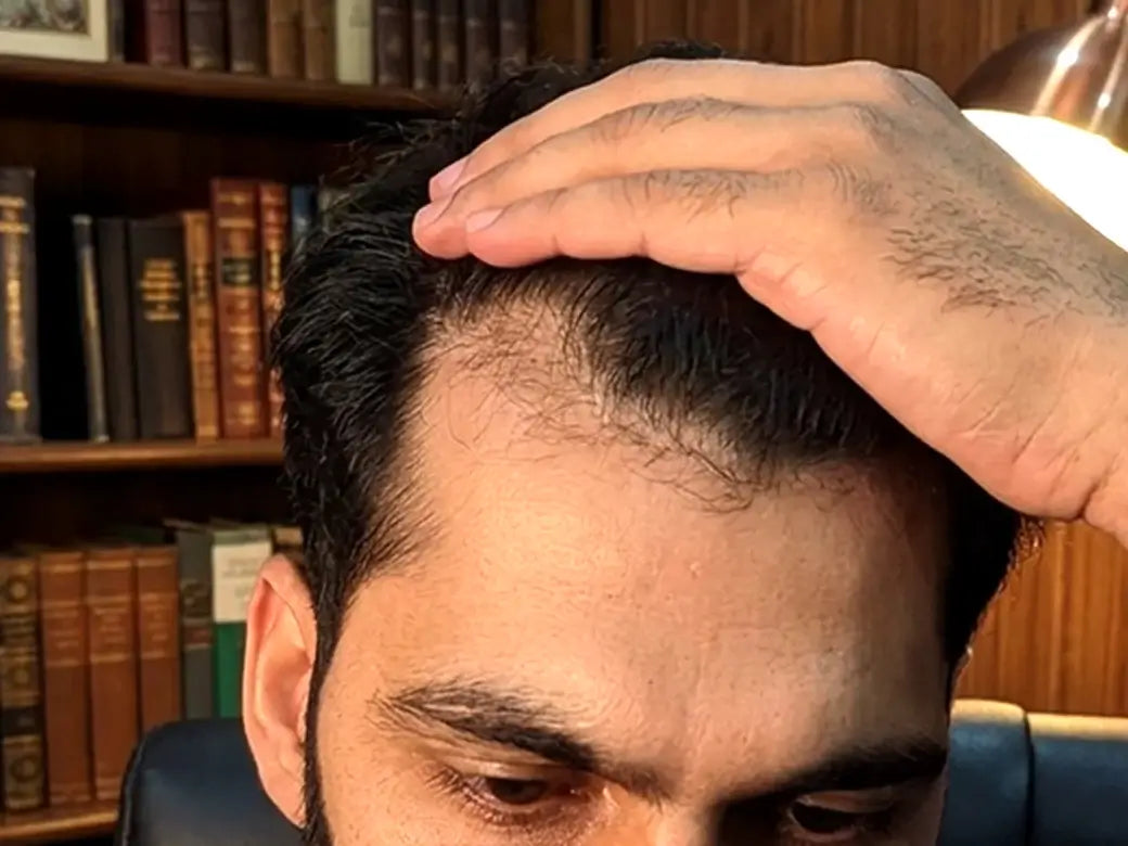 Before image